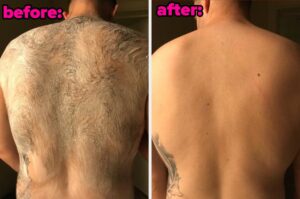 33 Products For All The Kinda Embarrassing Problems You’re Asking ChatGPT About