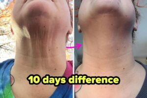 45 Products With Before And After Pics So Unbelievable, I’m Convinced Witchcraft Was Involved