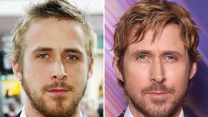 Ryan Gosling Good Genes or Good Docs?!