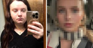 "Crazy How Lip Filler, Botox, Weight Loss, And A Hair Color Change Can Transform A Person": This Woman's Before And After Photos Have Left The Internet Completely Flabbergasted