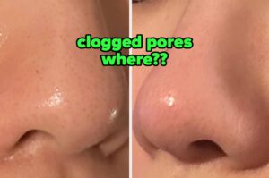 36 Things To Help With Warts, Fungus, Foul Breath, And Other Problems You’d Rather Not Speak Of