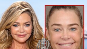 Denise Richards’ Before-and-After Pics Are Giving Her Surgeon’s Business a Lift