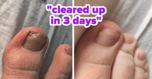 44 Things To Help With Some Your Body-Related Problems